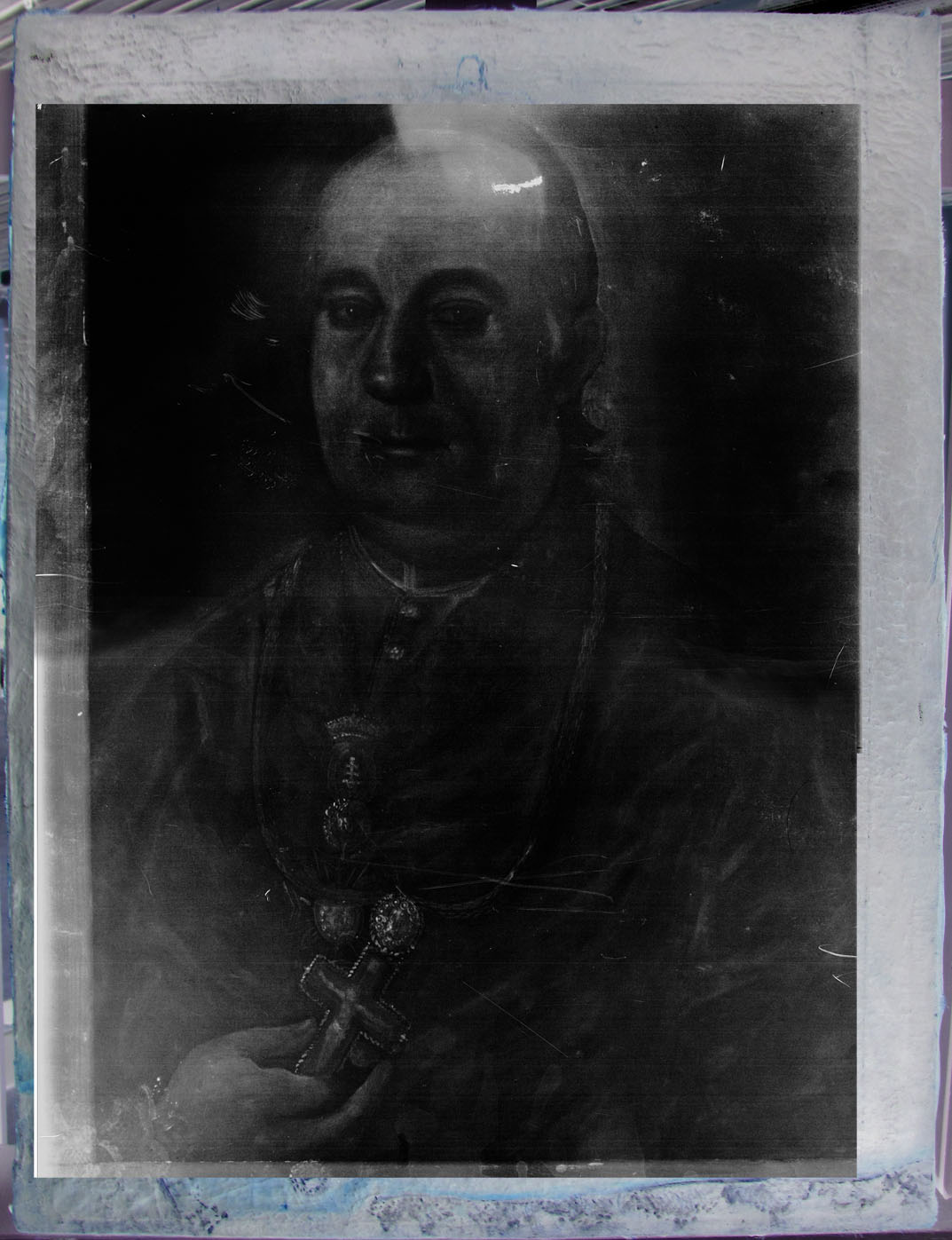 roentgen cely mensi.jpg